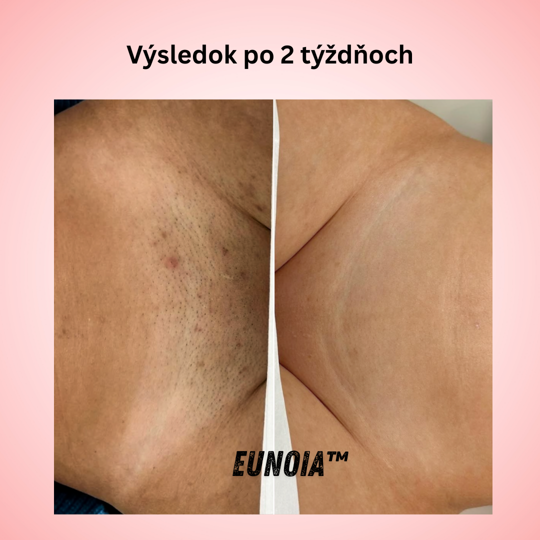 Eunoia™ Jemná starostlivosť pre citlivé oblasti