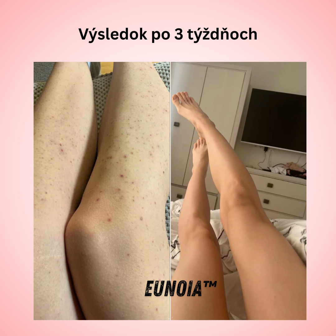 Eunoia™ Jemná starostlivosť pre citlivé oblasti