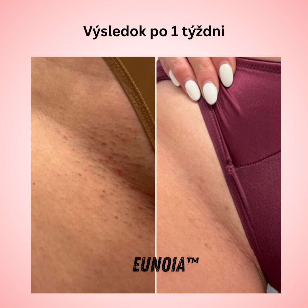 Eunoia™ Jemná starostlivosť pre citlivé oblasti