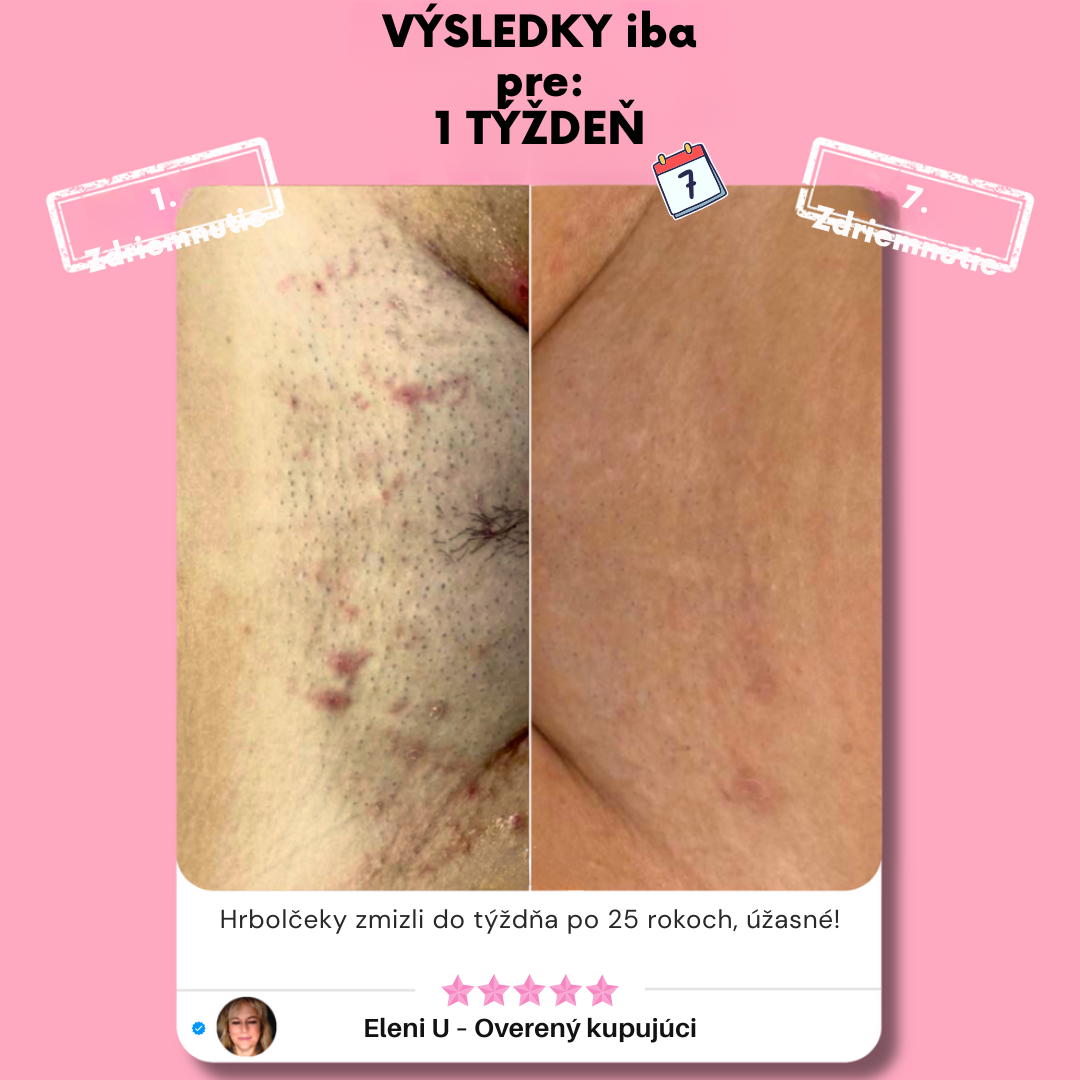 Eunoia™ Jemná starostlivosť pre citlivé oblasti