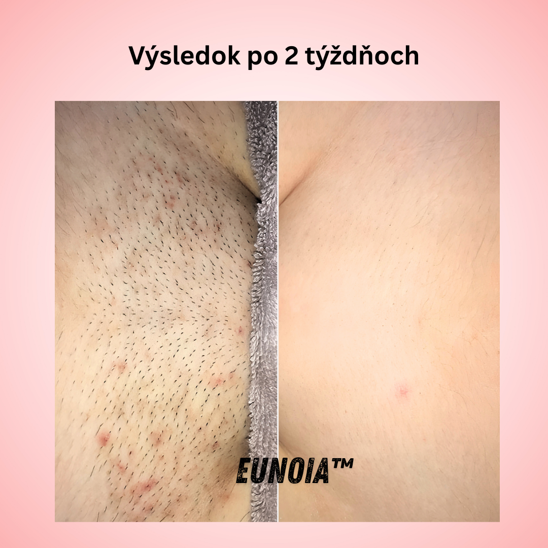 Eunoia™ Jemná starostlivosť pre citlivé oblasti